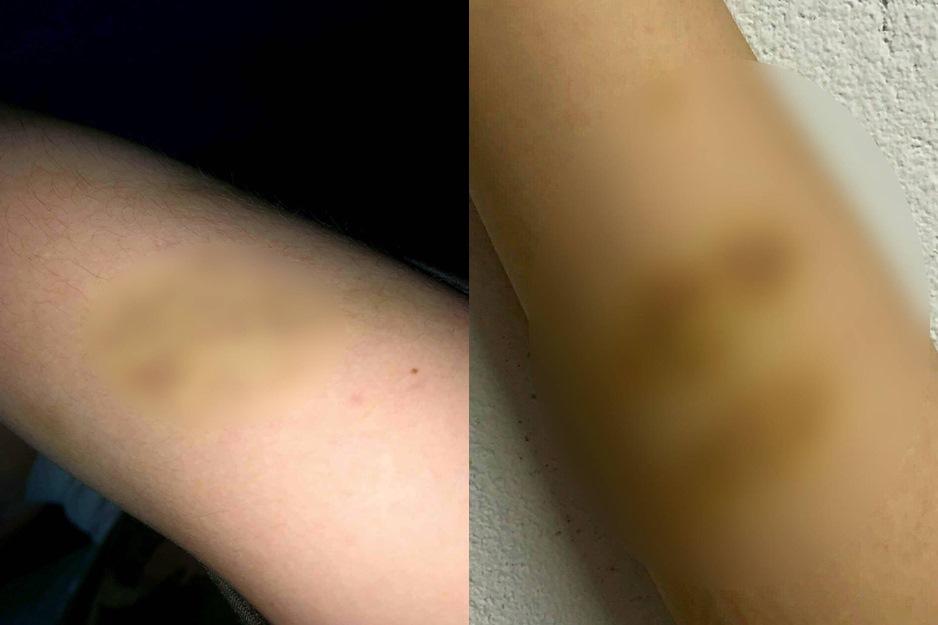 Nữ sinh F0 bị chủ trọ đuổi: Chủ nhà khẳng định không hành hung-3