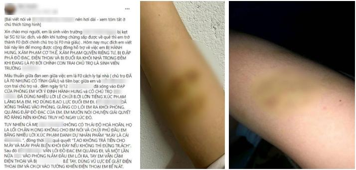 Chính quyền địa phương lên tiếng nữ sinh F0 tố bị hành hung-1