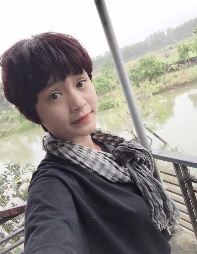 Choáng trước gương mặt sưng phồng vì dao kéo của Hiền Hồ-8