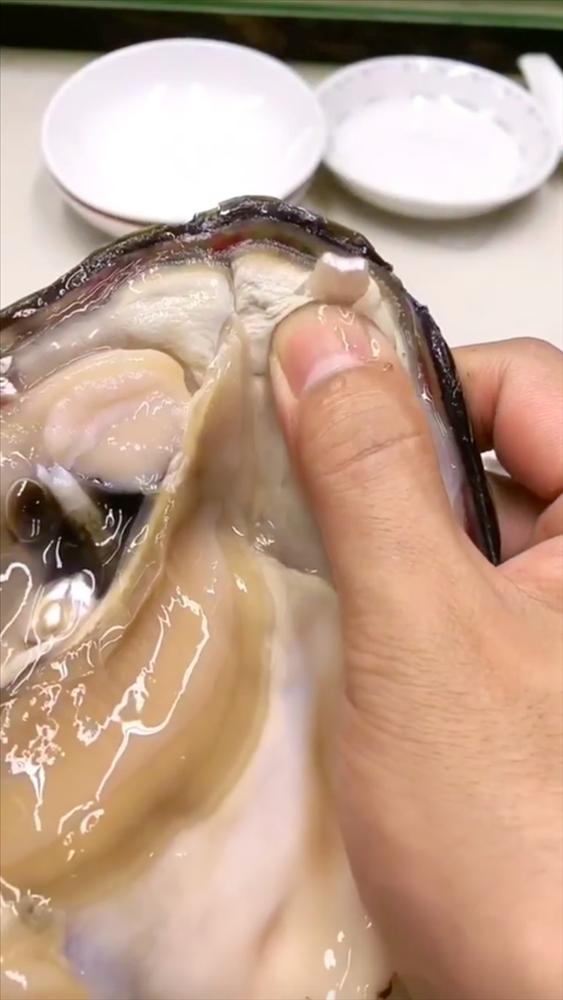 Mổ con trai ra thấy có viên ngọc, cô gái bị netizen mắng tàn nhẫn-3