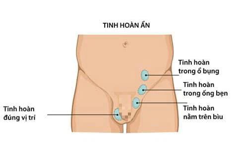 SỐC: Thanh niên bị thất lạc tin hoàn suốt 20 năm-1