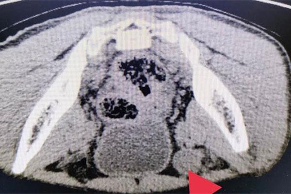 SỐC: Thanh niên bị thất lạc tin hoàn suốt 20 năm-2