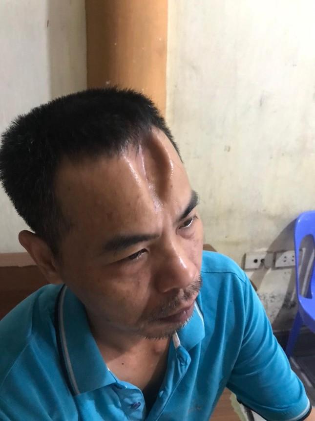 Dùng cào sắt đánh lún sọ, dập não hàng xóm đang phơi thóc-2