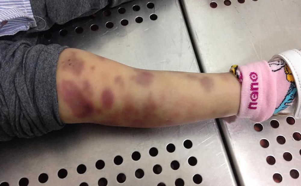 TP. HCM: Bé gái 8 tuổi tử vong, công an bắt khẩn cấp người yêu của bố-1