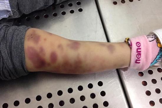 TP. HCM: Bé gái 8 tuổi tử vong, công an bắt khẩn cấp người yêu của bố