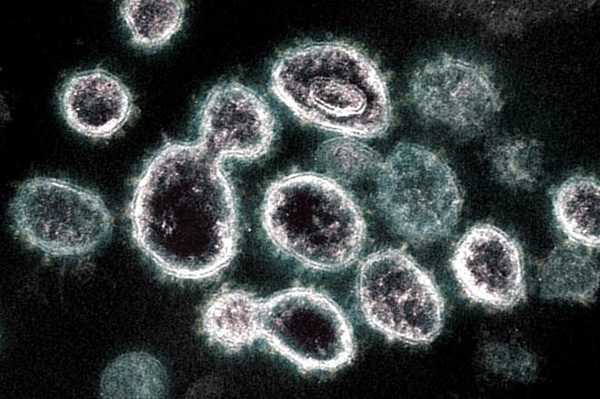 Virus SARS-CoV-2 có thể trú ẩn trong nội tạng hàng trăm ngày-1