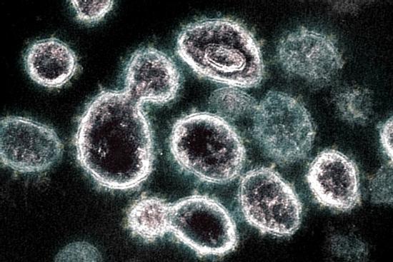 Virus SARS-CoV-2 có thể trú ẩn trong nội tạng hàng trăm ngày