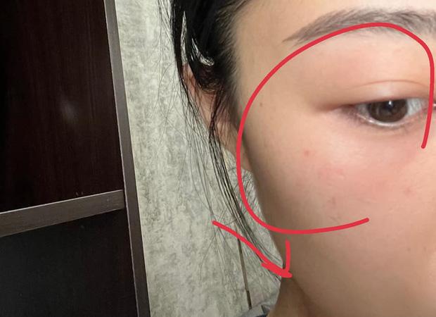 SỐC: Diễn viên H.N bị bạn gái tố bạo lực, lén lút ngủ với tình cũ-3