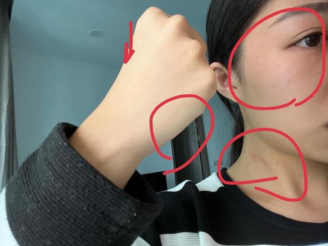 SỐC: Diễn viên H.N bị bạn gái tố bạo lực, lén lút ngủ với tình cũ-4