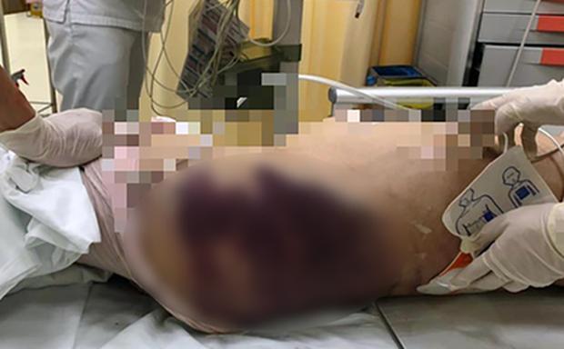 Bé gái bị dì ghẻ bạo hành tử vong: Mẹ ruột cả năm không được gặp con-1