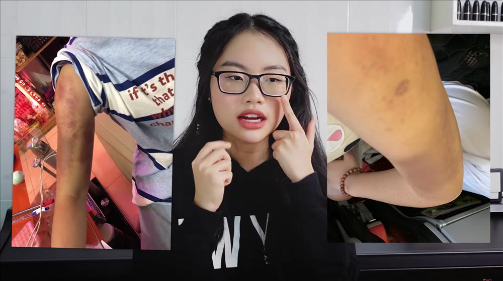 Bị chê xấu đê tiện, Phương Mỹ Chi giảm cân bất chấp đến mức ám ảnh!-2