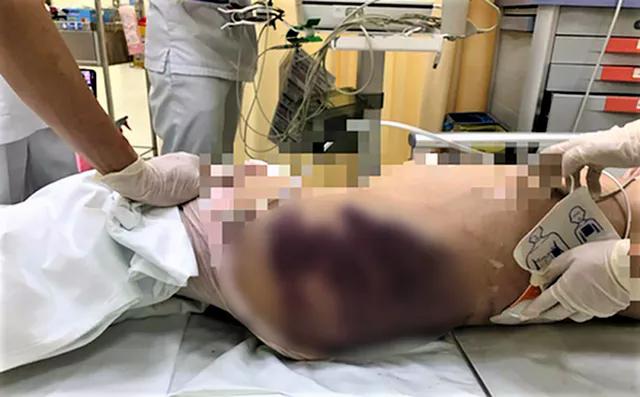 Cục trưởng Cục Trẻ em lên tiếng về vụ bé 8 tuổi bị bạo hành-2