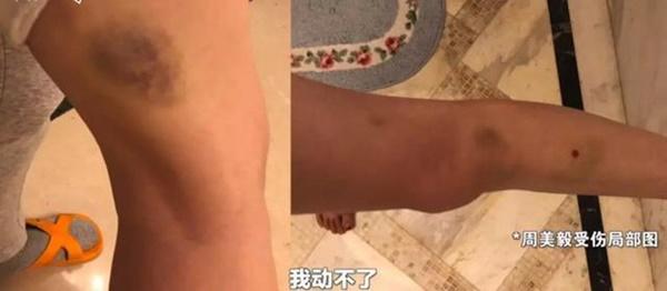 Nữ diễn viên bị tố bạo hành con đẻ dã man: Sự thật không ngờ-2