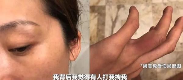 Nữ diễn viên bị tố bạo hành con đẻ dã man: Sự thật không ngờ-3