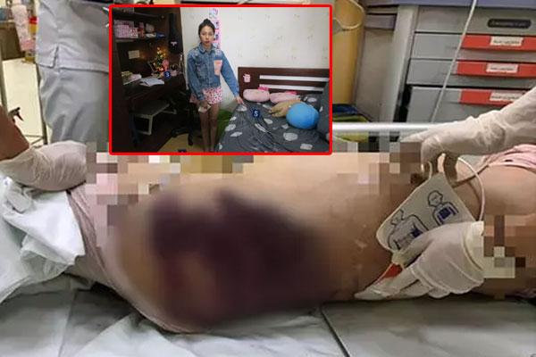 Vụ dì ghẻ bạo hành bé 8 tuổi: Hiểu đúng hiệu ứng Cinderella-3