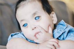 Bé gái 'mắt xanh' bị bỏ rơi 7 năm trước giờ thay đổi khó nhận ra