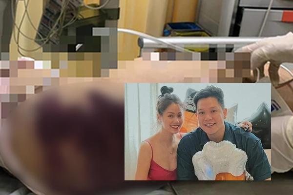 Lộ tin nhắn bố bé V.A. trả lời con bị tai nạn, không quan tâm dư luận-4