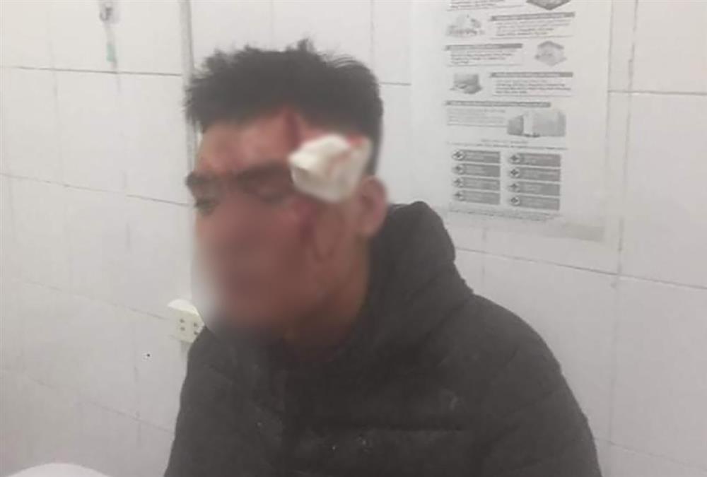 Clip: Nhóm thanh niên xông vào quán bida đập phá, chém người-1