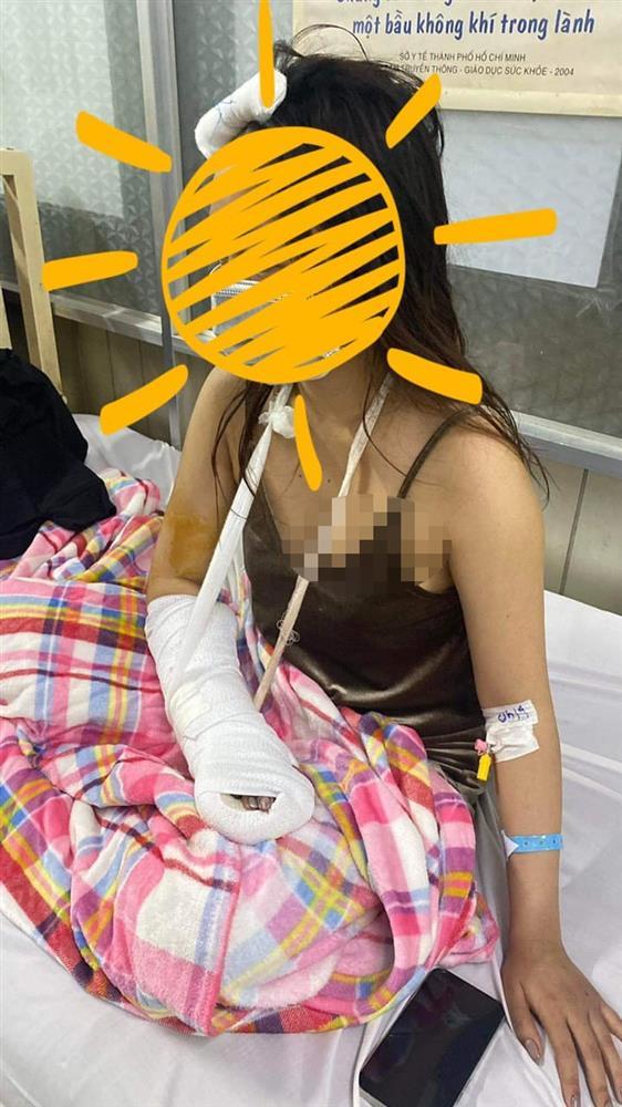 Không uống bia của trai lạ, cô gái bị truy sát đứt gân tay, vỡ đầu-2