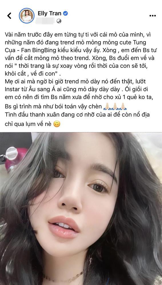 Elly Trần: Đi trùng tu nhan sắc bị bác sĩ... đuổi về và cái kết-1