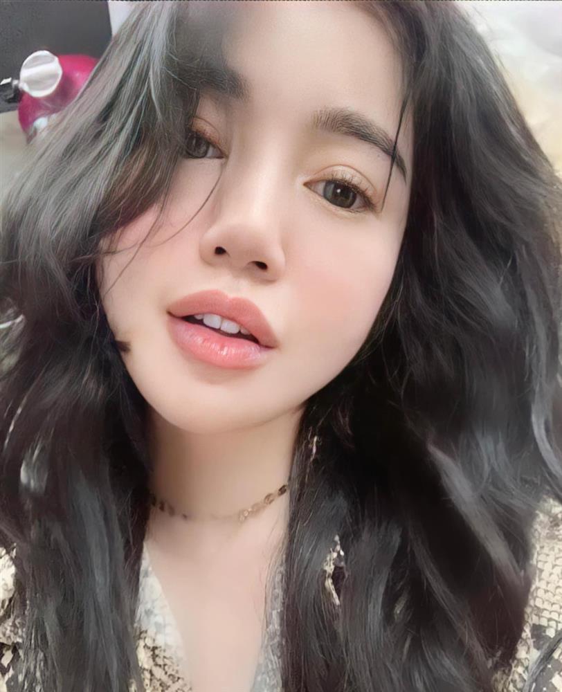 Elly Trần: Đi trùng tu nhan sắc bị bác sĩ... đuổi về và cái kết-2