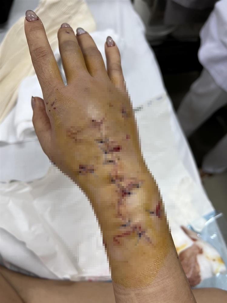 Lộ clip nhóm người đánh cô gái đứt gân tay, vỡ đầu tại quán nhậu-3