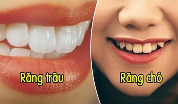 Nhìn tướng răng biết bạn là tỷ phú tương lai hay nông dân trọn kiếp?-1