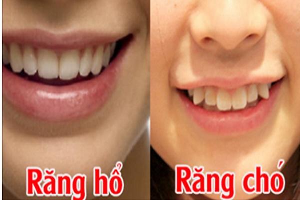 4 đặc điểm bàn tay tiêu tài tán lộc, cả đời lo lắng cơm áo gạo tiền-5