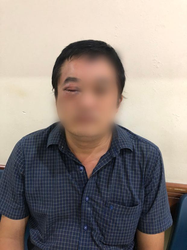 Clip: Nhóm giang hồ đánh đập dã man 1 giám đốc ở TP.HCM-1