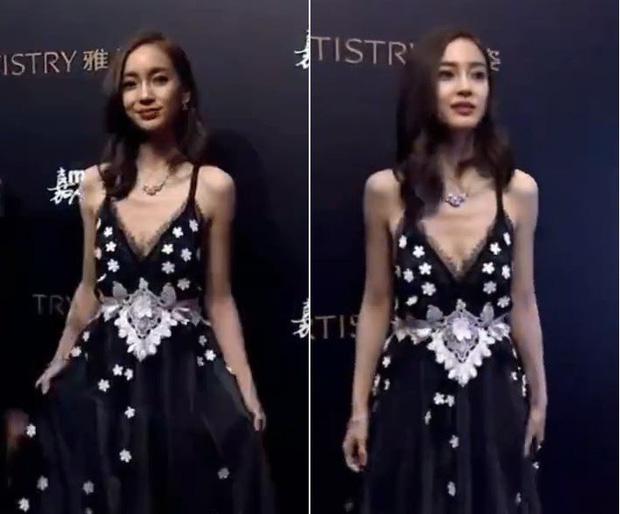 Giật mình sao Hoa ngữ: Lộ xương ngực, trơ xương sườn-4