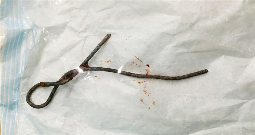 Học theo phim ảnh, bé trai 5 tuổi nhét thanh sắt vào hậu môn-2