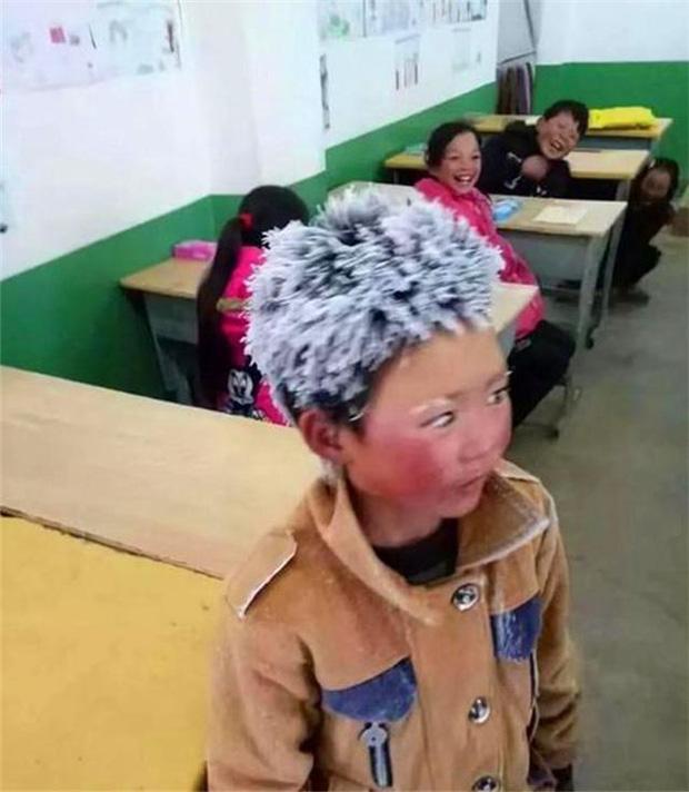 Cuộc sống cậu bé đóng băng khiến cả châu Á đau lòng 4 năm trước-1