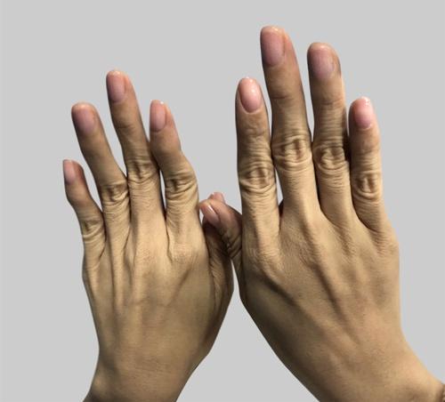 4 đặc điểm bàn tay tiêu tài tán lộc, cả đời lo lắng cơm áo gạo tiền-1