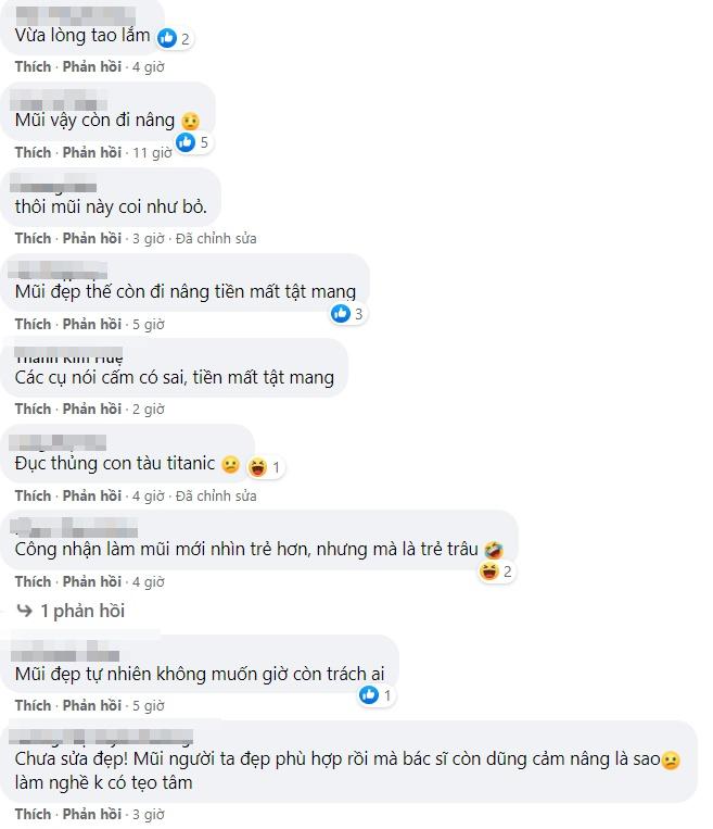 Già vẫn ham hố nâng mũi, bà mẹ nhận kết thảm thương-5