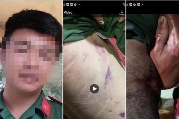 Truy nã 2 bị can chặn đánh nam quân nhân tử vong ngoài đường-2