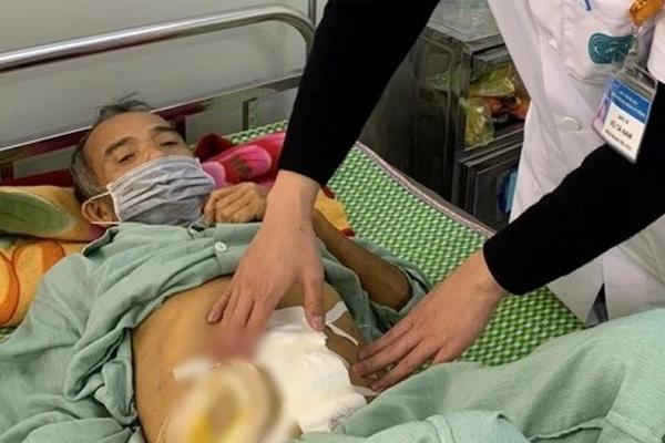 Người đàn ông thủng ruột, nhiễm độc toàn thân sau bữa liên hoan-1