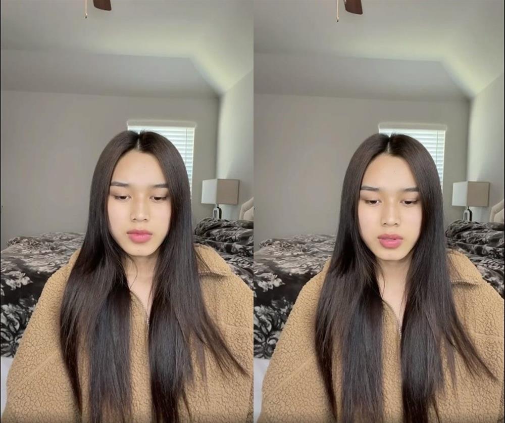 Đỗ Thị Hà gầy xác xơ, tóc rụng cả nắm vì nhiễm Covid-19-7