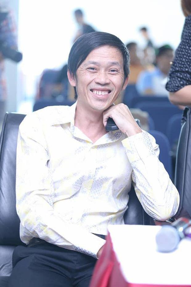 Netizen phát hiện Hoài Linh thẩm mỹ 1 điểm vì gương mặt khác lạ-2