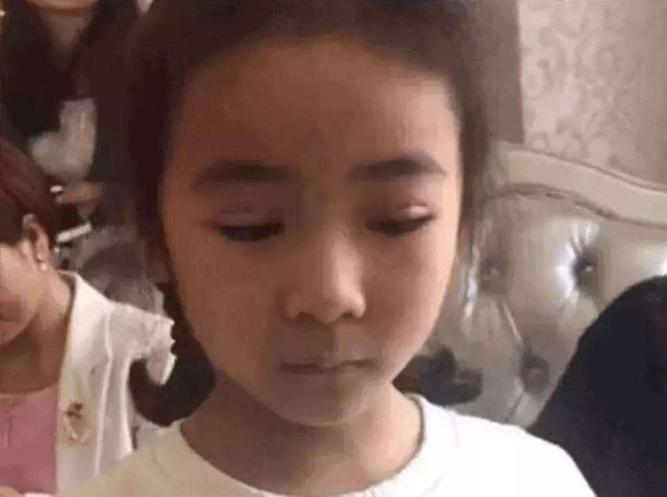 Bé gái Trung Quốc 7 tuổi được mẹ đưa đi cắt mí-1