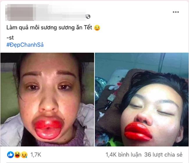 Gái xinh phun môi đón Tết và cái kết méo mỏ, sưng như bị đấm-1