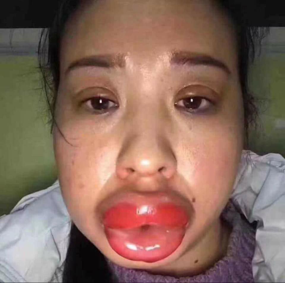 Gái xinh phun môi đón Tết và cái kết méo mỏ, sưng như bị đấm-2