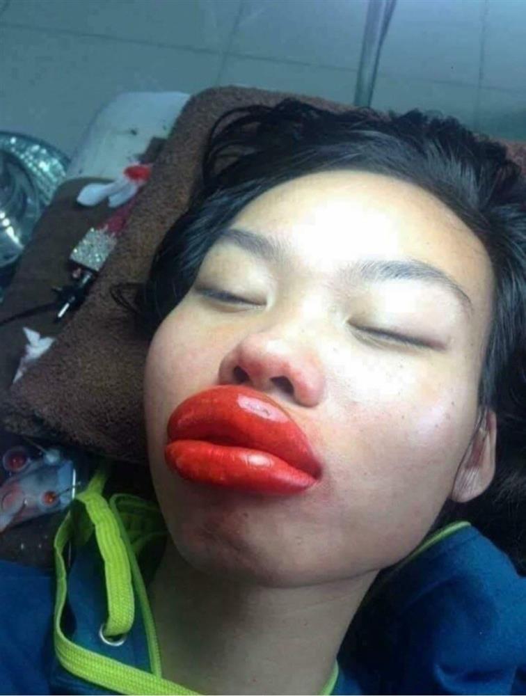 Gái xinh phun môi đón Tết và cái kết méo mỏ, sưng như bị đấm-3