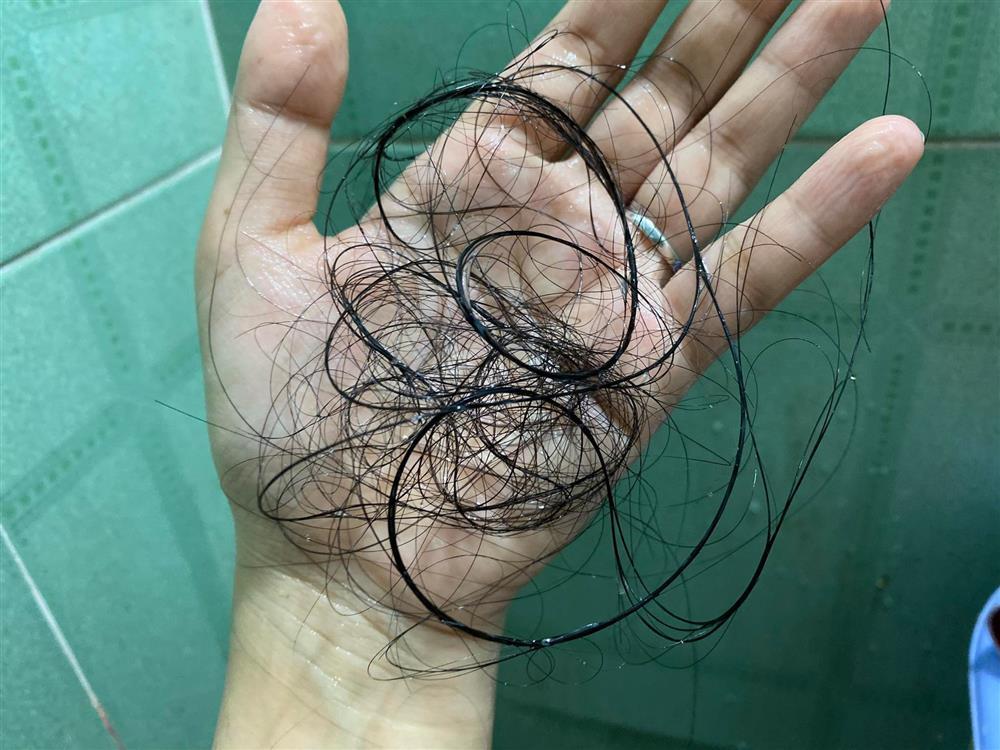 F0 có thực sự an toàn sau khi khỏi bệnh?-1