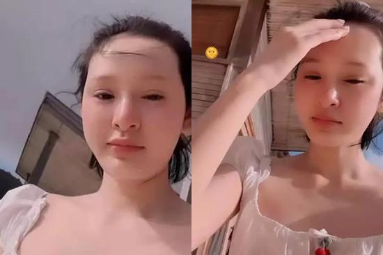 Choáng trước gương mặt sưng phồng vì 'dao kéo' của Hiền Hồ