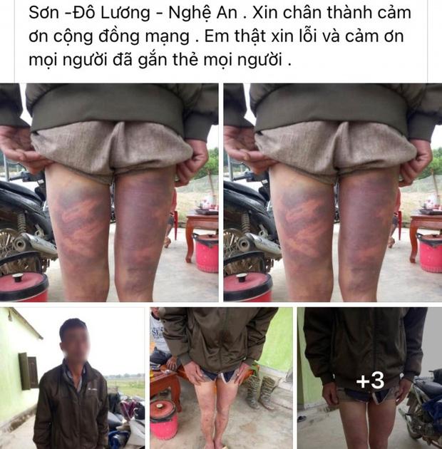 Vụ dân tố bị còng tay đánh bầm tím: Người nhà công an mang 5 triệu đến?-1