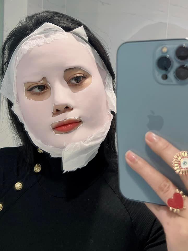 Phương Oanh đăng ảnh mặt sưng phồng: Chuyện gì đây?-4