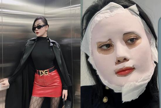 Phương Oanh đăng ảnh mặt sưng phồng: Chuyện gì đây?