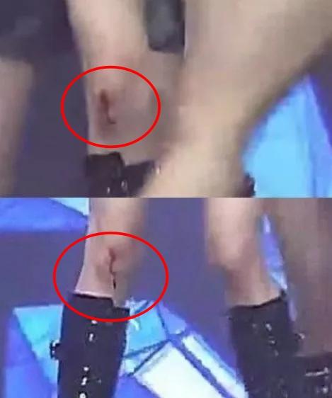 Wonyoung IVE đã bị rách đầu gối tới chảy máu vẫn nhảy như không có gì-3