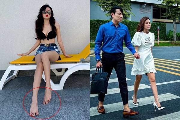 Body xịt máu mũi của người yêu tin đồn Midu-11