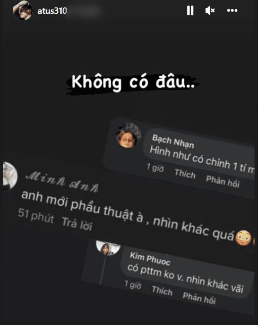 Bạn trai Diệu Nhi bị nghi trông con mọn còn phẫu thuật thẩm mỹ-4